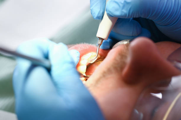 Best Emergency Dental Care for Sports Injuries in Garden City South, NY